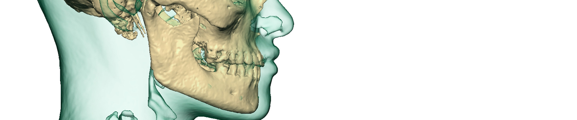 chirurgie orthognatique